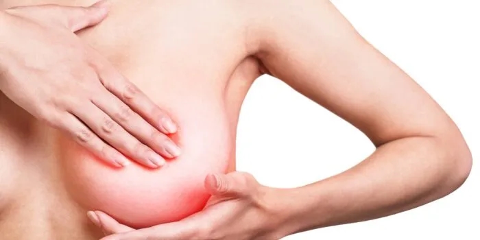 Zapalenie piersi podczas karmienia - rozpoznaj pierwsze objawy i zapobiegaj