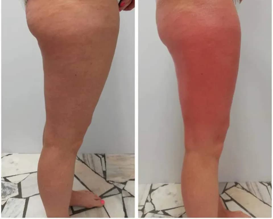 Gdzie kupić SPA Abyss na cellulit? Skuteczne miejsca i opinie