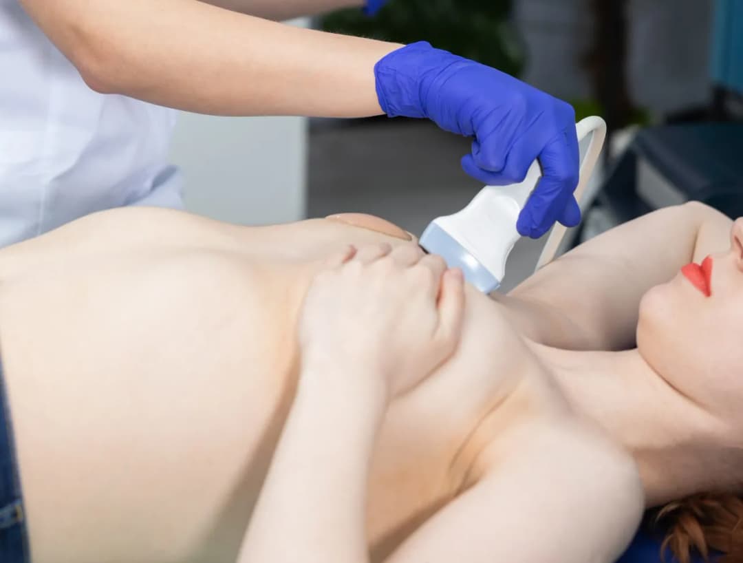 Jak leczyć zwapnienia w piersiach? Poznaj skuteczne metody i zalecenia