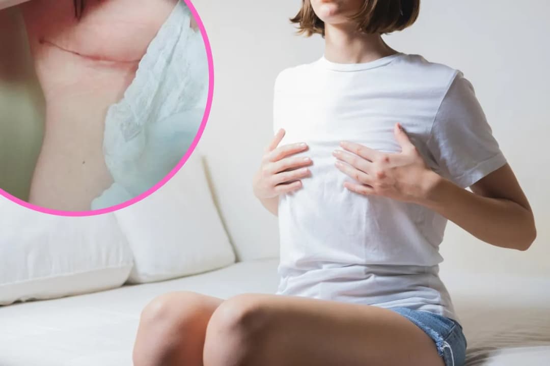 Gdzie i jak zmniejszyć biust na NFZ: lista ośrodków i kroki do refundacji