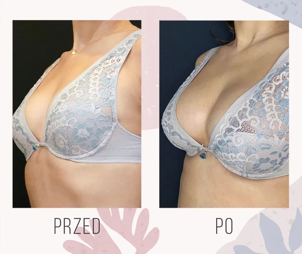 Od czego zależy wielkość biustu? Poznaj wszystkie naturalne czynniki